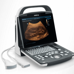 DP10 Ultrasound machine