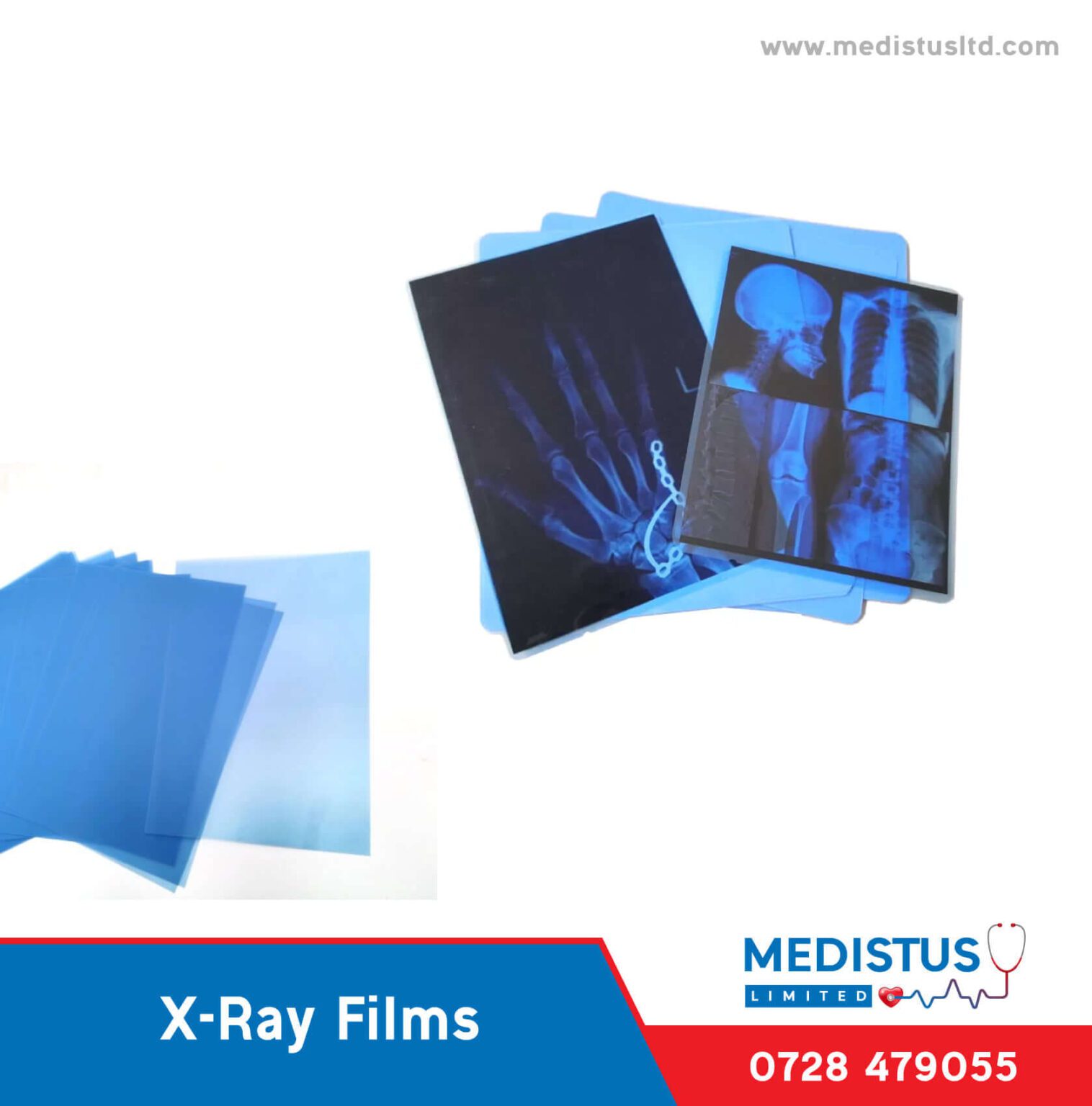 XRay films Medistus Limited