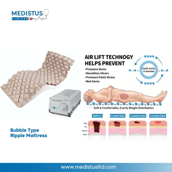 Bubble Type Ripple Mattress - Image 3